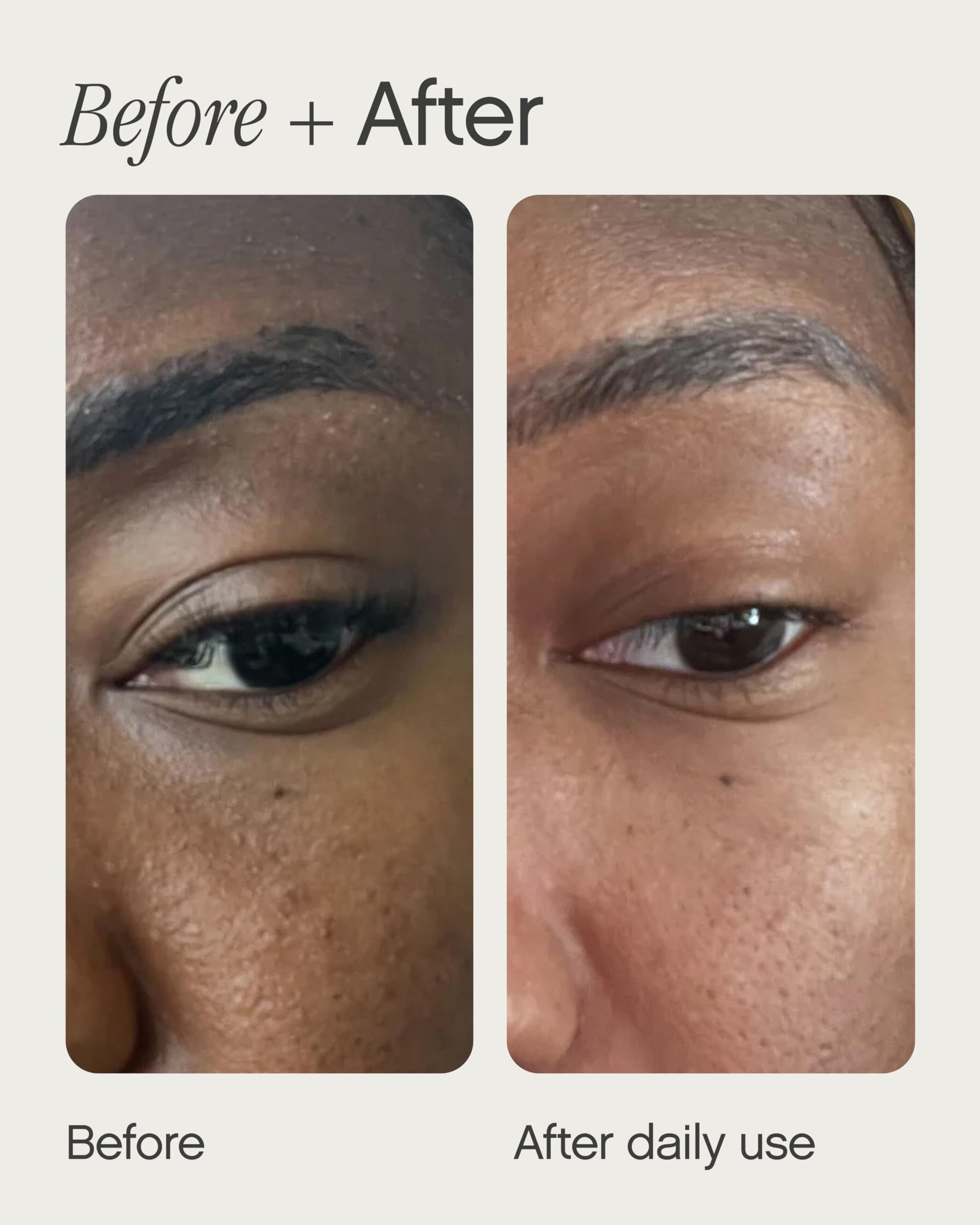 Topicals Sealed Active Scar Filling Primer for Acne Prone Skin - Good for Blemishes, Pores, Acne & Dryness - Contains Retinol and Salicylic Acid - 1 Oz